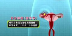 囊胚移植后第7天出现出血，和宫外孕可能有关