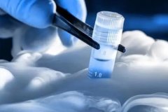 试管选择医院精子，费用详解及注意事项！