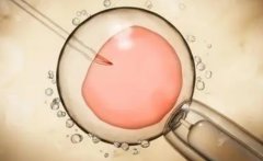 孕妇促排卵，能否“定制”男孩？专家解析真相！