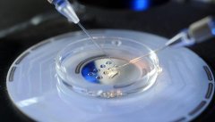 对照这5点，看看你要做几次试管才能成功？