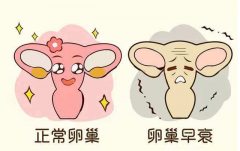 卵巢“提前退休”大揭秘！提前了解原因，预防早衰不是梦！