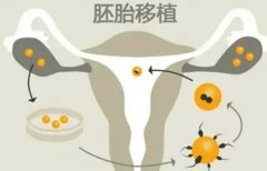 试管移植子宫内膜有什么要求？什么时候移植最好？