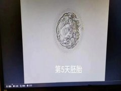 一文了解D5冻胚质量等级，需要注意影响冻胚因素