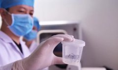 重庆公立医院供精试管费用怎么样？