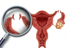卵巢“小情绪”？别急，心态调整是关键！