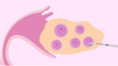 试管取卵后，如何让卵巢更快恢复？