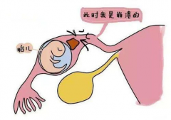 移植后“肚子不对劲”？宫外妊娠症状大揭秘，腹痛可是“警报器”！