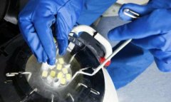 正规机构保存一年受精卵需要多少钱？