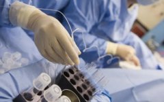 取卵之后我们要注意哪些问题?睡觉姿势有要求吗?