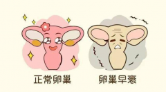 卵巢“提前退休”预警！骨折也来凑热闹？警惕这8大信号！