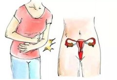 子宫内膜异位症患者可以怀孕吗？