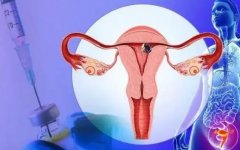 注意子宫内膜异位三大危害，子宫内膜异位症具有家族遗传性