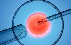 收藏！弓形子宫的治疗方法，弓形子宫自然受孕几率较小