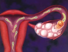 多囊卵巢综合征的“解围”攻略，你get了吗？