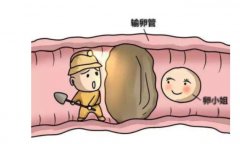 输卵管结扎能试管吗？多久才能做手术？