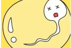 基因缺陷影响精子成活率,还受这些因素影响
