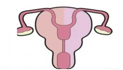 双角子宫外观呈双角状，双角子宫保胎要格外注意