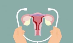 子宫需不需要经常保养?一般都是怎么保养子宫的?