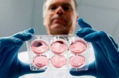 深度解析：美国第三代试管技术表现如何？生男孩费用高昂吗？