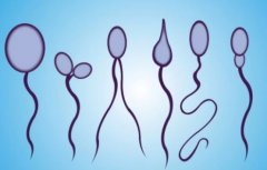 精子畸形率98％的男性是否可以受孕？