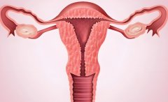 子宫内膜厚怎么办?子宫内膜厚能不能靠运动变薄?