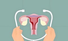 子宫切除后还有性反应吗?子宫切除后对女性有什么影响?