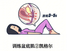 【科普】凯格尔盆底肌详细操作步骤和方法