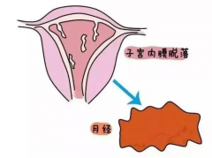 内膜厚度影响试管移植成功率吗？影响比较大