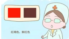 怀孕有褐色分泌物是怎么回事？出血后褐色分泌物会持续几天？