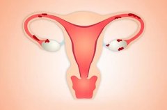 子宫内膜异位症术后如何预防复发？