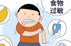食物过敏怎么治疗？患者要注意这些生活习惯