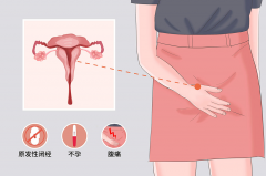 先天性无子宫的月经与生育之“谜”