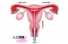 不同的病因影响人工授精的成功率，还受其他因素影响