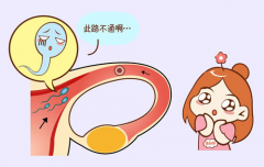 未怀过孕输卵管也可能堵塞，堵塞原因主要有以下这些