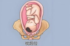 什么是枕前位和枕后位?枕前位和枕后位区别是什么?