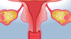 如何让扩张的子宫回归常态？探索子宫缩小的有效方法