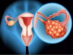 多囊遇上试管：抓住这几个关键点，轻松调出卵泡好质量！