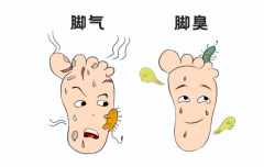 脚气初期症状及自我治疗方法