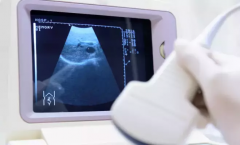 试管40天B超：胎儿健康发育的关键“透视镜”