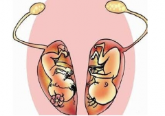 双子宫是少见的先天性畸形，双子宫的注意事项