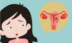 宫腔炎引起妇女的不适感，可以采取这些治疗措施