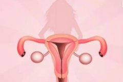 如何治疗子宫肌瘤？一文了解宫腔镜检查的作用