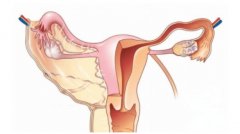 收藏！一文了解子宫造影前需要做的检查