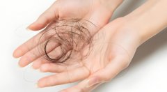 孕期掉头发的原因有哪些?孕期脱发如何治疗呢?