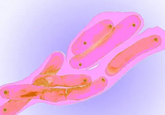 输卵管结核，试管依然可行！快来了解治疗方案