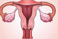 一文了解子宫内膜异位症的原因，及时找到病因治疗