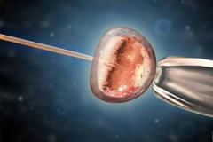 试管预算大揭秘！提前掌握费用，让你的生育计划更稳更顺