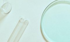 宫腔镜检查的目的是什么？宫腔镜检查的成功率如何？