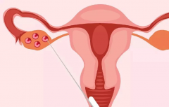 试管取卵数量的合理范围与考量因素