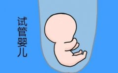 中信湘雅试管包男孩是真的吗？可以相信吗？